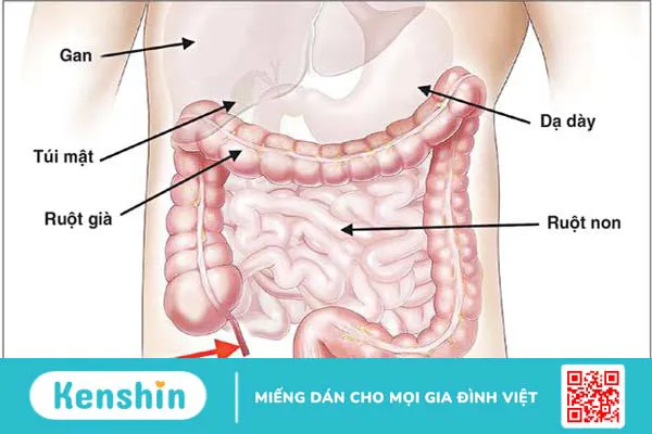 Viêm ruột do bức xạ: Cơ chế, triệu chứng và cách điều trị 1