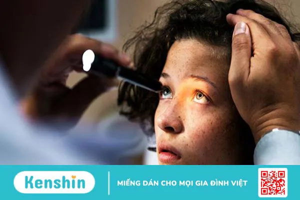 Viêm thị thần kinh Leber: Nguyên nhân, triệu chứng, chẩn đoán và điều trị 1