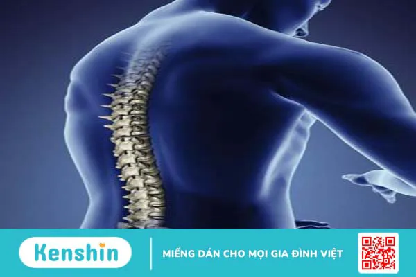 Viêm tủy sống và những điều cần biết 4