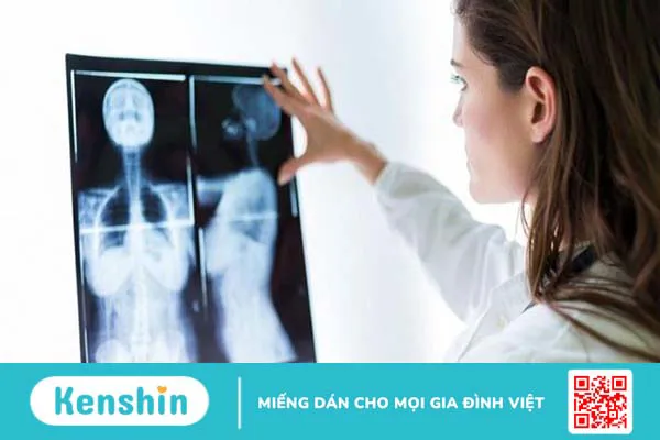 Xạ hình xương: Phương pháp xét nghiệm bệnh hiệu quả 3