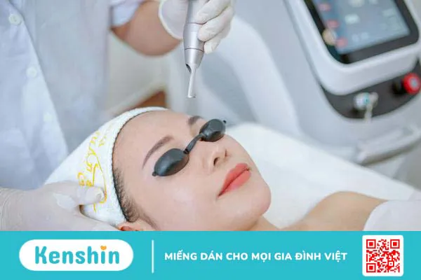 Xăm lông mày bị hỏng: Nguyên nhân và cách khắc phục 4