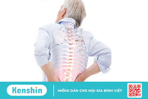 Xẹp đốt sống lưng D12 và những điều cần biết về bệnh 1