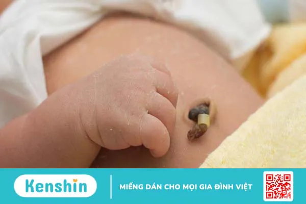 Xét nghiệm ADN bằng cuống rốn tiến hành như thế nào? 2