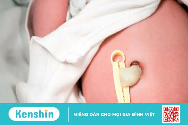 Xét nghiệm ADN bằng cuống rốn tiến hành như thế nào? 3