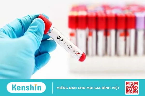 Xét nghiệm CEA - Phương pháp chẩn đoán các bệnh ung thư +1