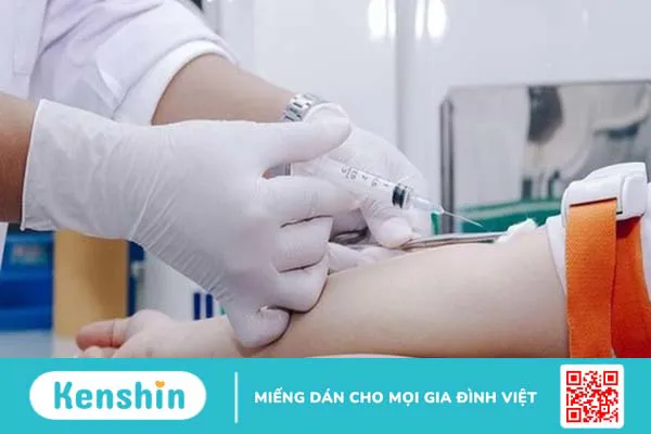 Xét nghiệm CEA - Phương pháp chẩn đoán các bệnh ung thư  + 4