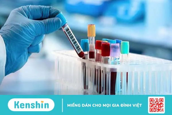 Xét nghiệm CEA - Phương pháp chẩn đoán các bệnh ung thư +5