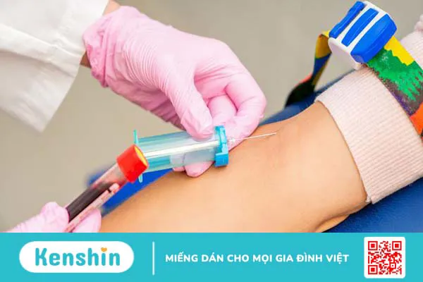 Xét nghiệm combo sau 21 ngày là gì? Hướng dẫn chi tiết cách thực hiện xét nghiệm combo sau 21 AG/AB 2