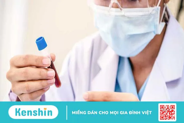 Xét nghiệm đột quỵ và phương pháp ngăn ngừa đột quỵ 2