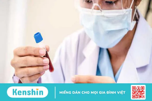 Xét nghiệm máu có phát hiện ung thư dạ dày không? 1