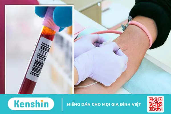 Xét nghiệm máu có phát hiện ung thư dạ dày không? 2