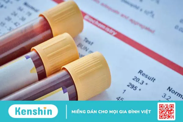 Xét nghiệm máu có thai nhưng siêu âm đầu dò không thấy là vì sao? Nguyên nhân và cách xử trí 1