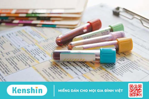 Xét nghiệm máu XY là gì? Có chính xác không? 4