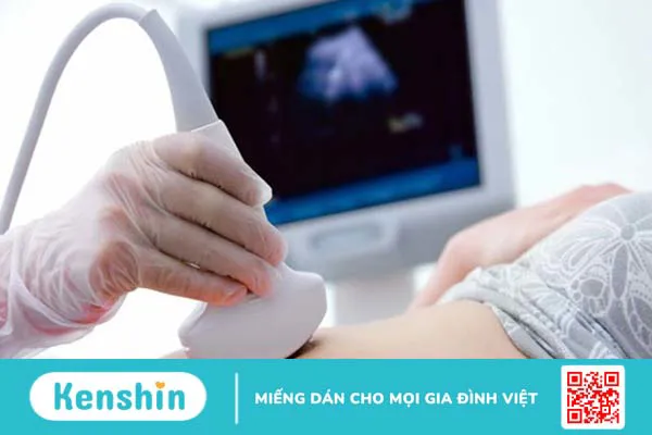 Xét nghiệm u xơ tử cung: Tầm quan trọng và cách đề phòng bệnh 4