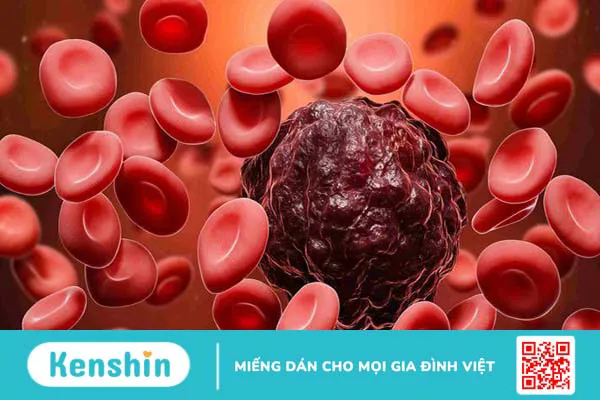 Xét nghiệm ung thư máu giúp phát hiện ung thư máu giai đoạn sớm