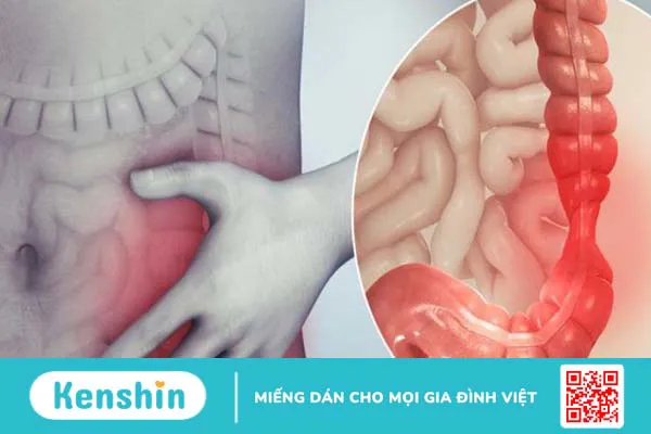 Xoắn ruột: Nguyên nhân, triệu chứng và cách điều trị 1