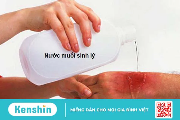 Công dụng của nước muối sinh lý: làm sạch vết thương