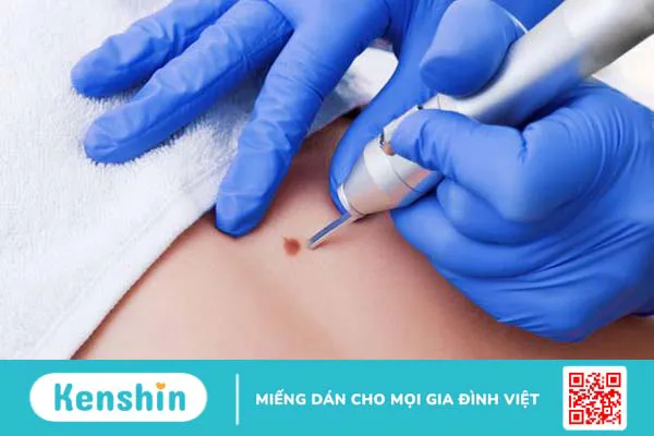 Bà bầu bị sùi mào gà có chữa được không? 3