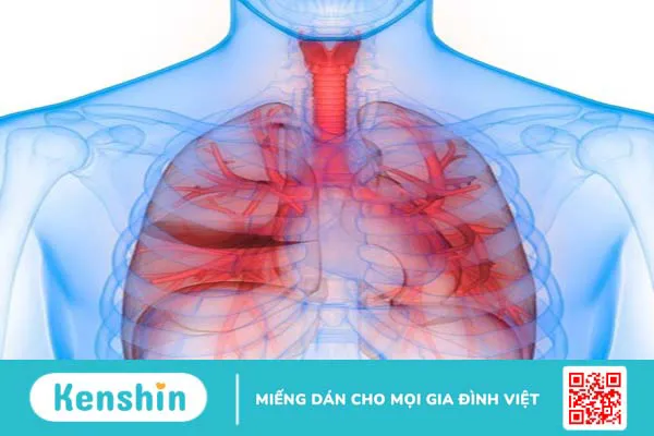 Thiếu oxy thầm lặng thường thấy ở bệnh nhân Covid-19 có bệnh nền là hen suyễn