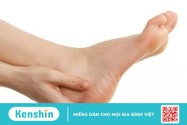 Bàn chân lõm sâu là gì? Nhận biết bàn chân lõm sâu