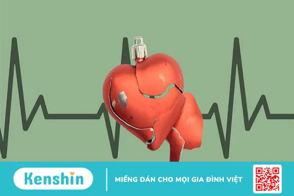 Bệnh suy tim có chữa được không? Các phương pháp điều trị và phòng ngừa suy tim 2