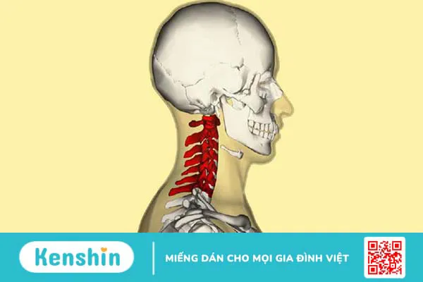 Tìm hiểu nguyên nhân và phương pháp điều trị các bất thường khớp nối sọ-cổ 1