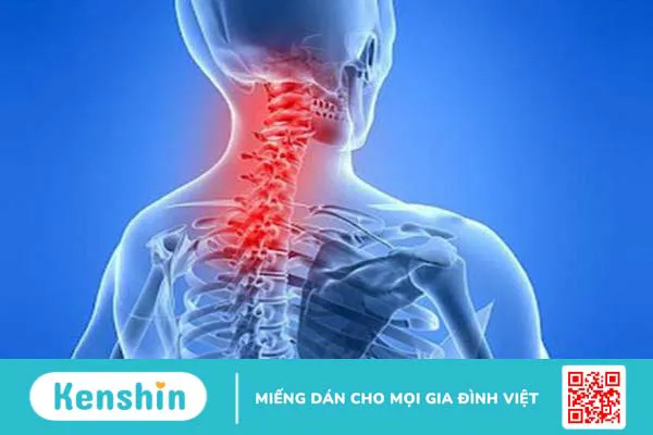 Tìm hiểu nguyên nhân và phương pháp điều trị các bất thường khớp nối sọ-cổ 2