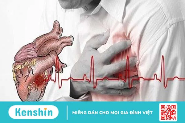 cac-loai-stent-mach-vanh-duoc-su-dung-hien-nay-gom-nhung-loai-nao 2