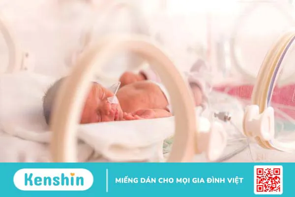 Cách dạy trẻ bị rối loạn ngôn ngữ hiệu quả 3