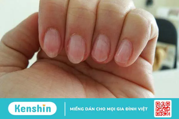 Cách làm móng tay nhanh dài trong 2 ngày tại nhà 1