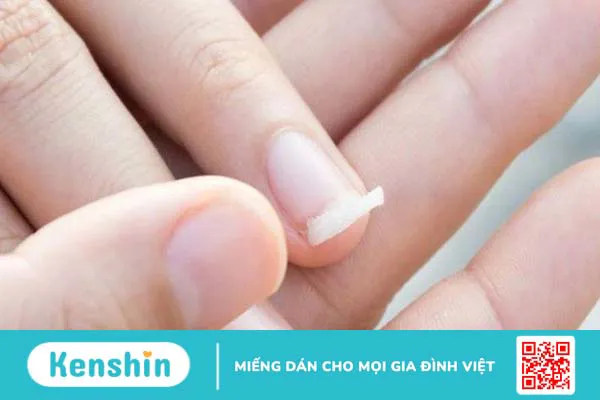 Cách làm móng tay nhanh dài trong 2 ngày tại nhà 2