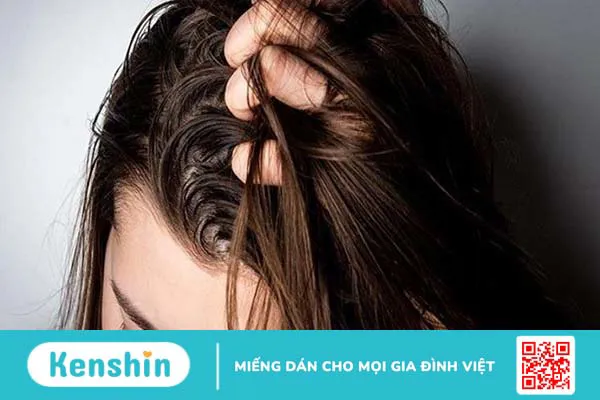 Cách trị tóc dầu bết dính bằng muối đơn giản tại nhà 1