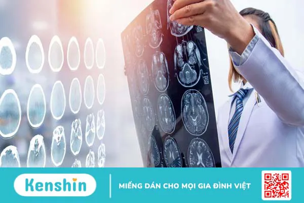 Chấn thương đầu là gì? Triệu chứng khi bị chấn thương đầu 2