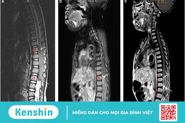 Chụp cộng hưởng từ cho trẻ em - Ảnh hưởng như thế nào đến sức khoẻ? 3