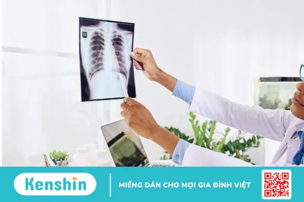 Chụp X quang ngực giúp phát hiện bệnh gì? Quy trình chụp thế nào 2