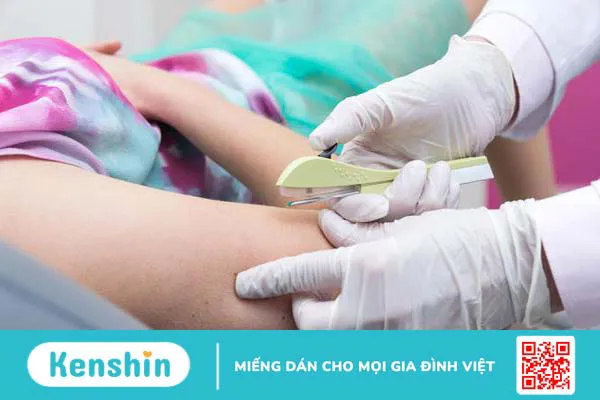 Chuyên gia tư vấn: Cấy que tránh thai có đau không? 2