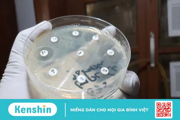 Clo test: Phương pháp chẩn đoán nhiễm vi khuẩn HP 6