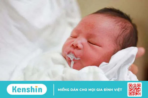 Có nên sử dụng thuốc chống nôn trẻ em không? Những lưu ý khi dùng thuốc chống nôn trẻ em 1