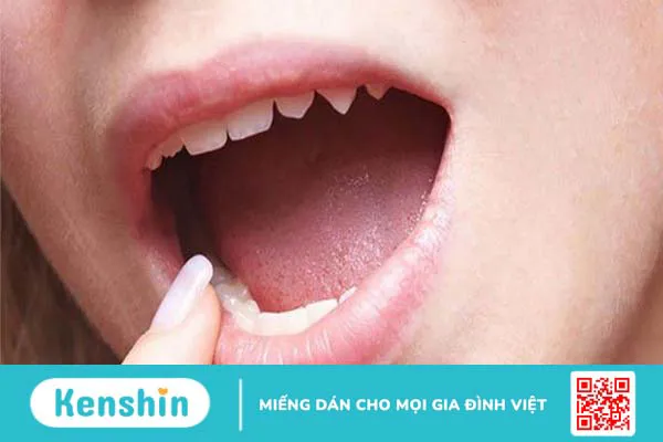 Góc giải đáp: Daktarin Oral Gel có trị nhiệt miệng không? 2