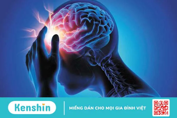 Đau đầu sét đánh: Nguyên nhân và các triệu chứng phổ biến 1