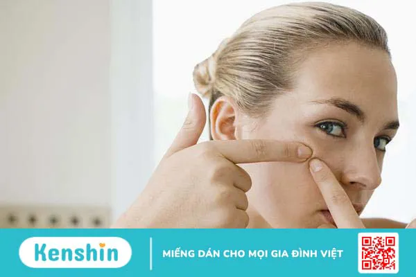 Điểm danh 5 loại thuốc trị mụn ẩn tốt nhất được bác sĩ khuyên dùng 2