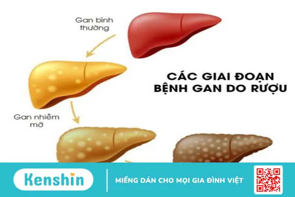 Dùng rễ cây xấu hổ ngâm rượu mang lại nhiều lợi ích bất ngờ 6