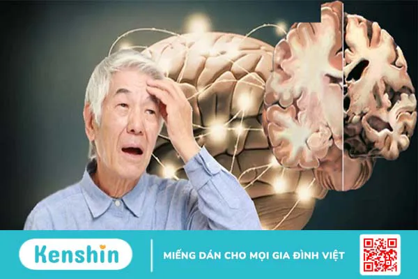 Đường làm trầm trọng thêm bệnh Alzheimer: Bạn có biết? 1