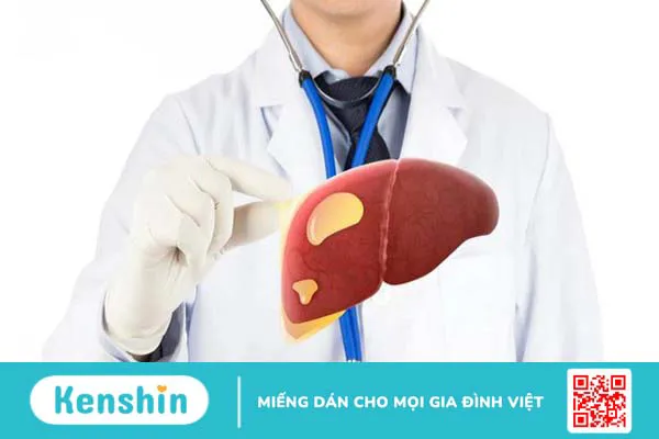 Người bệnh cần chú ý gì khi dùng thuốc điều trị gan nhiễm mỡ độ 2