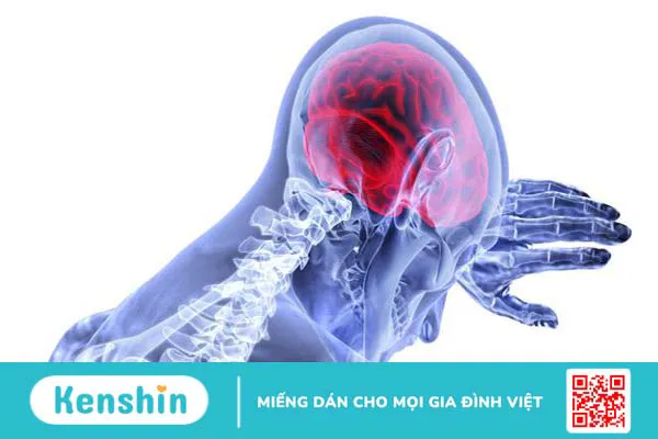 Giải đáp: Đau đầu về chiều là bị bệnh gì? Làm cách nào điều trị? 3