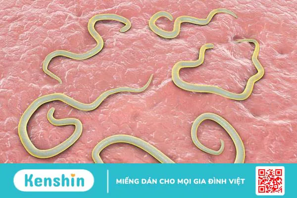 Giun kim ký sinh ở đâu? Cách nhận biết và phòng ngừa hiệu quả 1