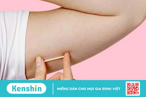 Góc giải đáp: Sinh xong bao lâu thì cấy que tránh thai được? 1