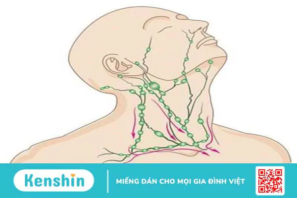 hạch hoại tử vùng cổ và những đều cần biết