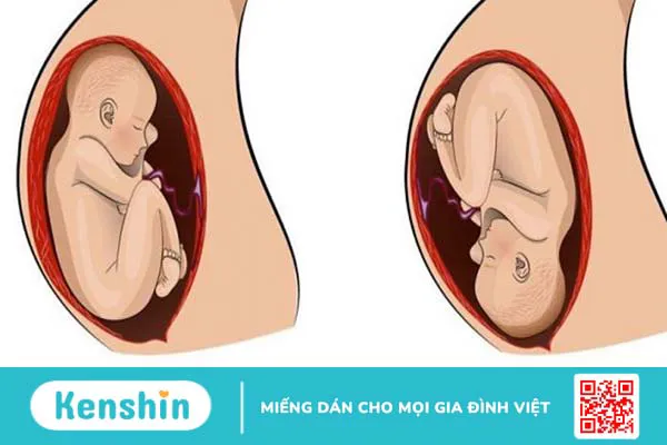 Loạn sản khớp háng có nguy hiểm không? -3