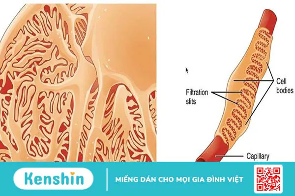 Màng lọc cầu thận là gì và bệnh lý cầu thận màng 1